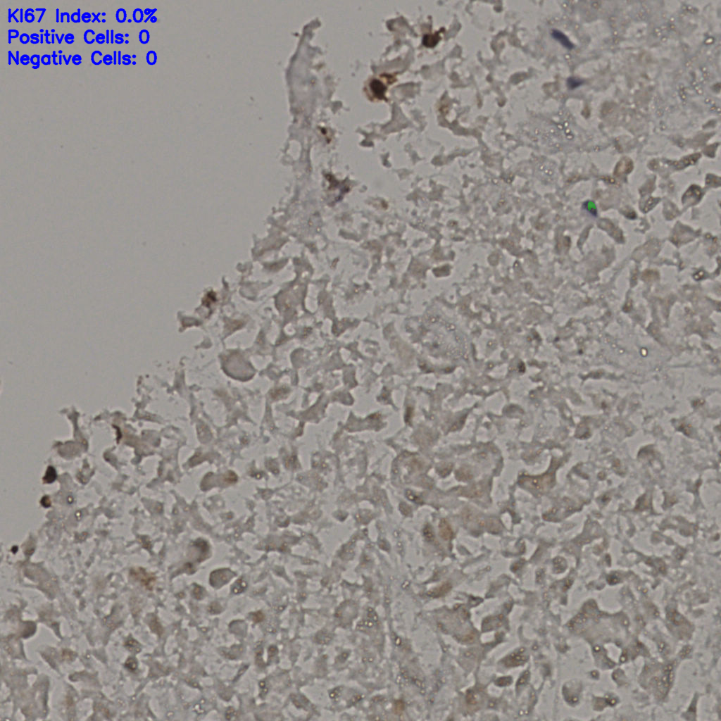 slice_18_37_x16128_y33152.png