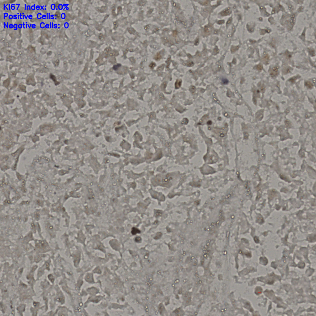 slice_18_38_x16128_y34048.png