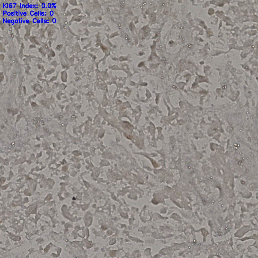 slice_18_39_x16128_y34944.png