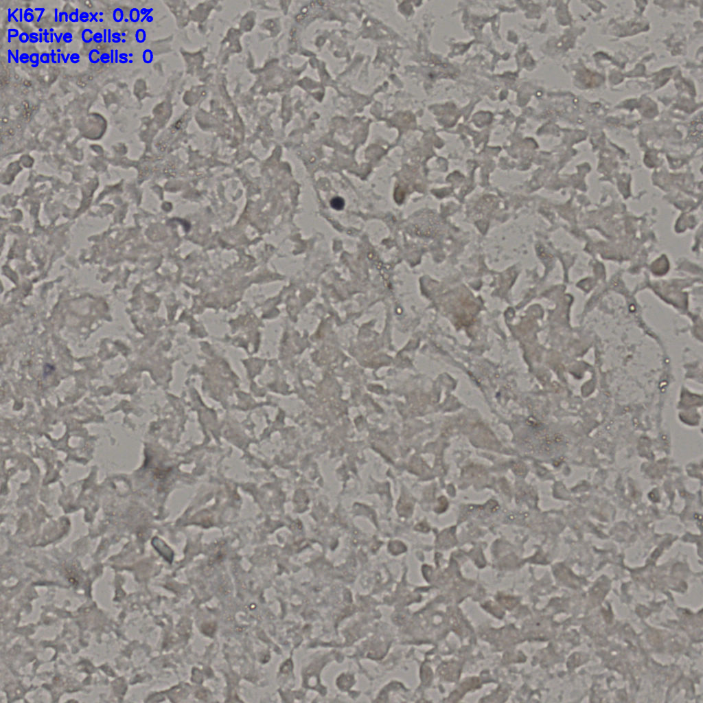 slice_18_41_x16128_y36736.png
