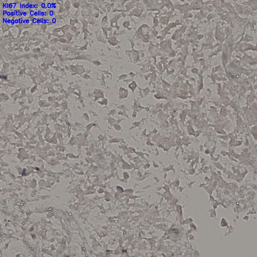 slice_18_42_x16128_y37632.png