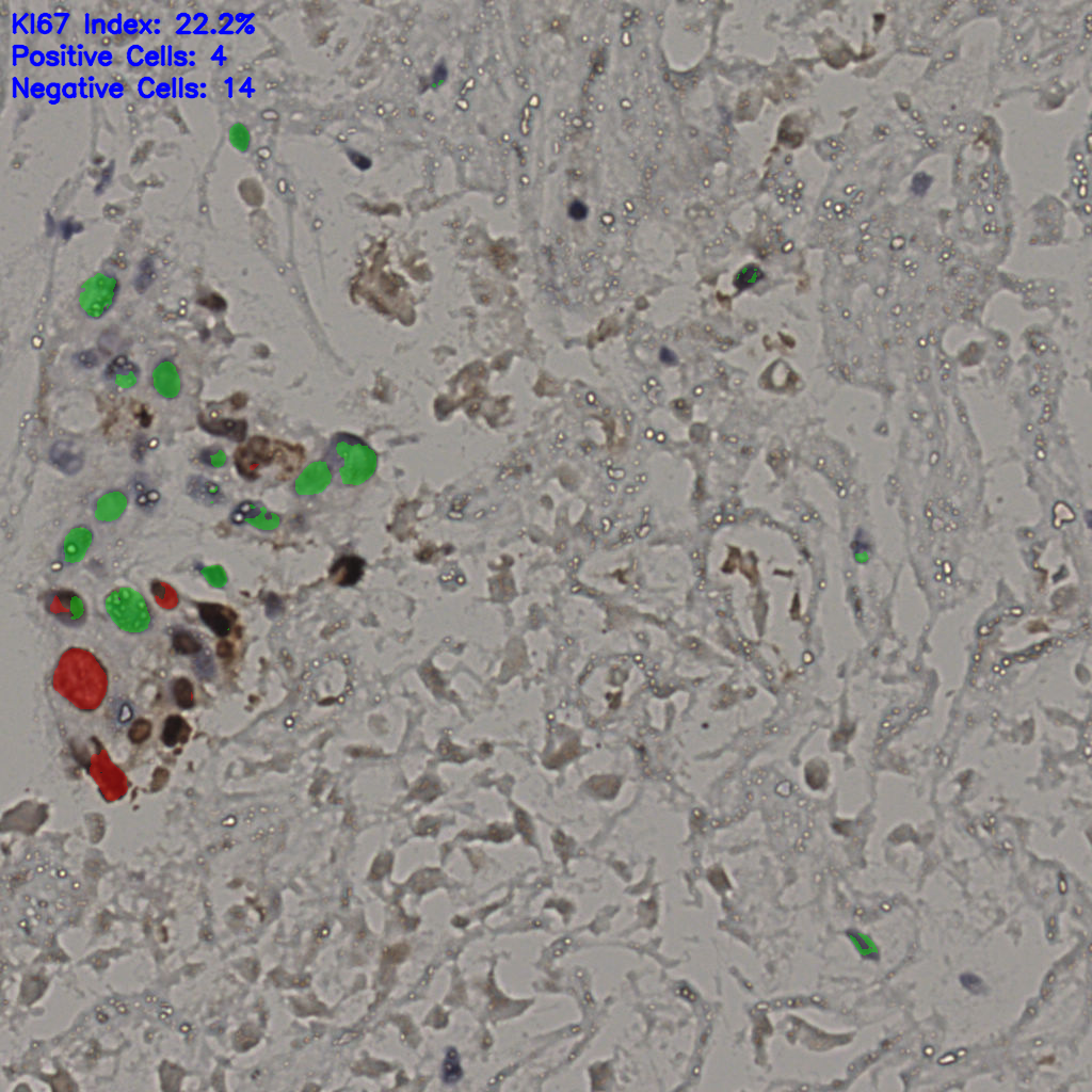 slice_18_44_x16128_y39424.png