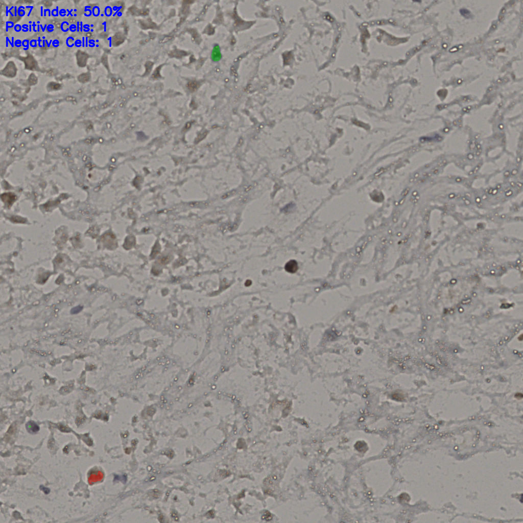 slice_18_45_x16128_y40320.png