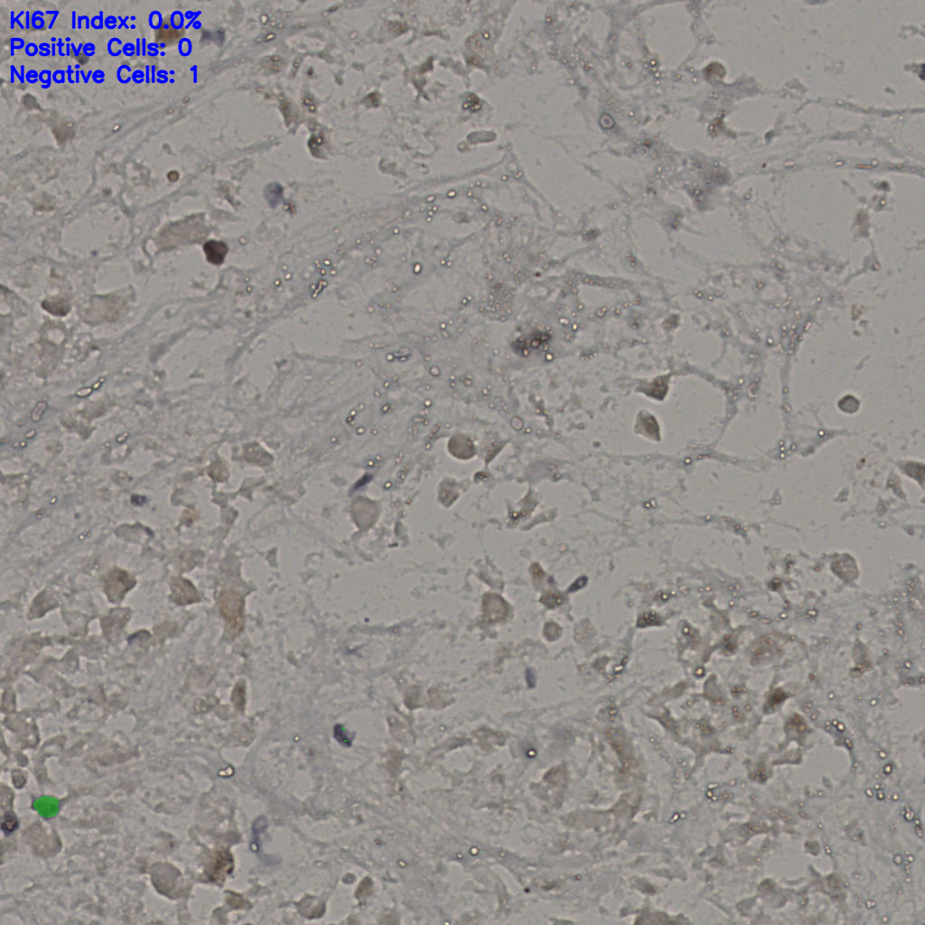 slice_18_46_x16128_y41216.png