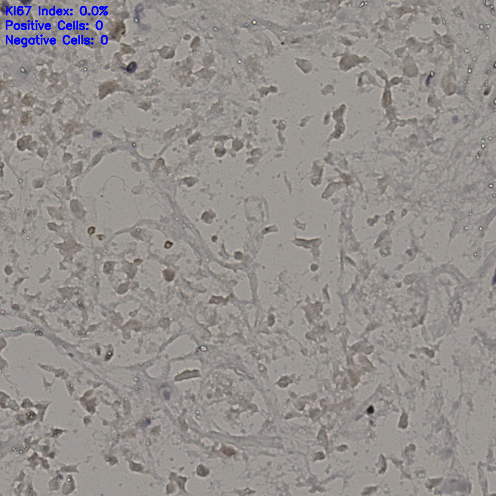 slice_18_47_x16128_y42112.png