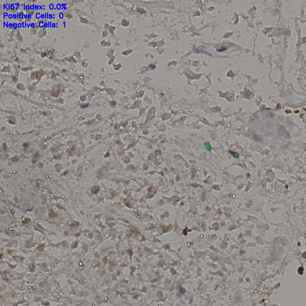 slice_18_48_x16128_y43008.png