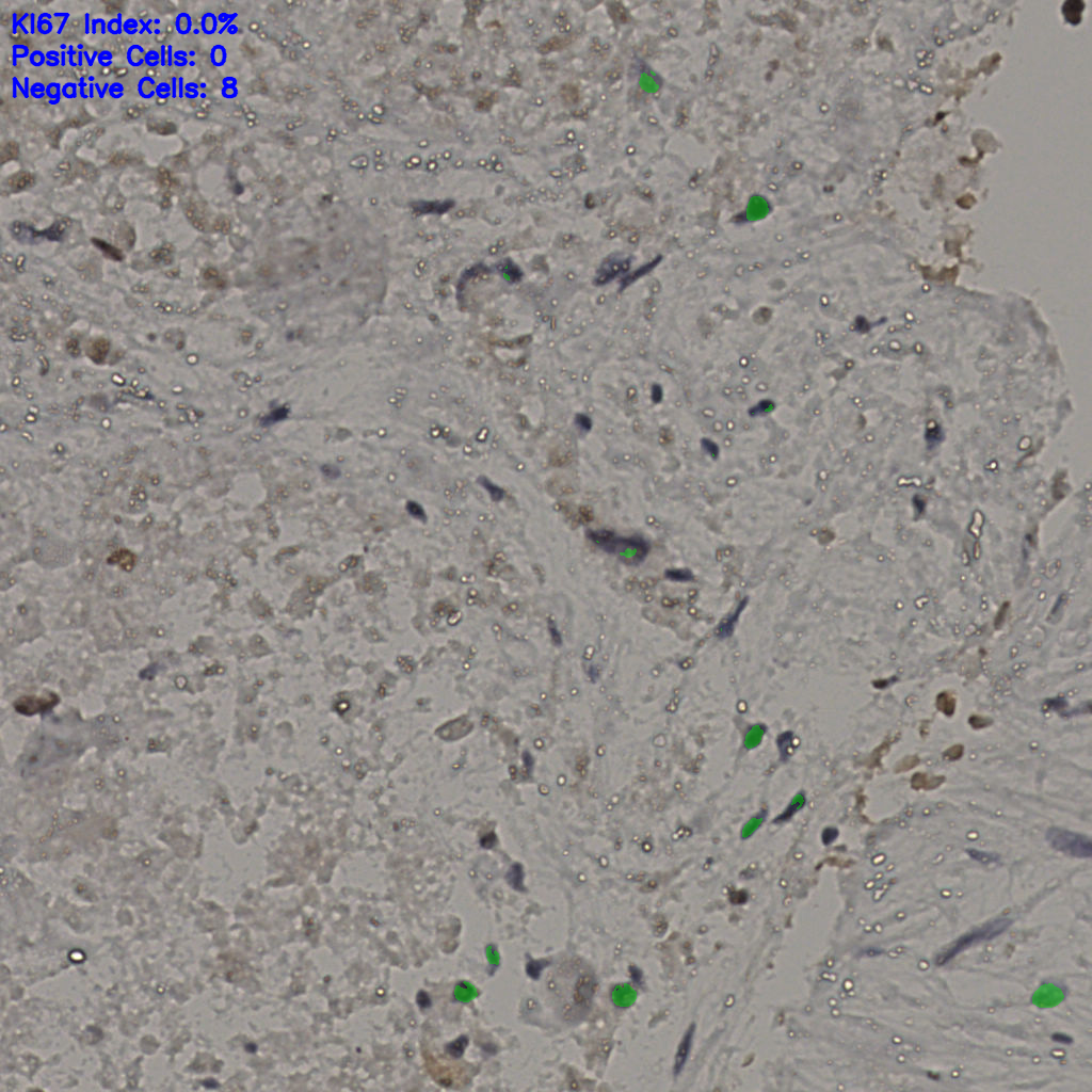 slice_18_49_x16128_y43904.png