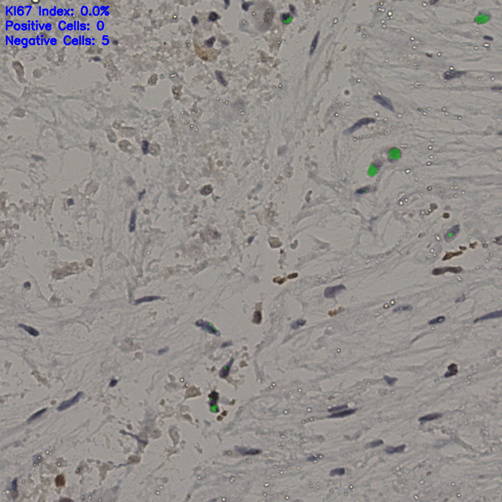 slice_18_50_x16128_y44800.png