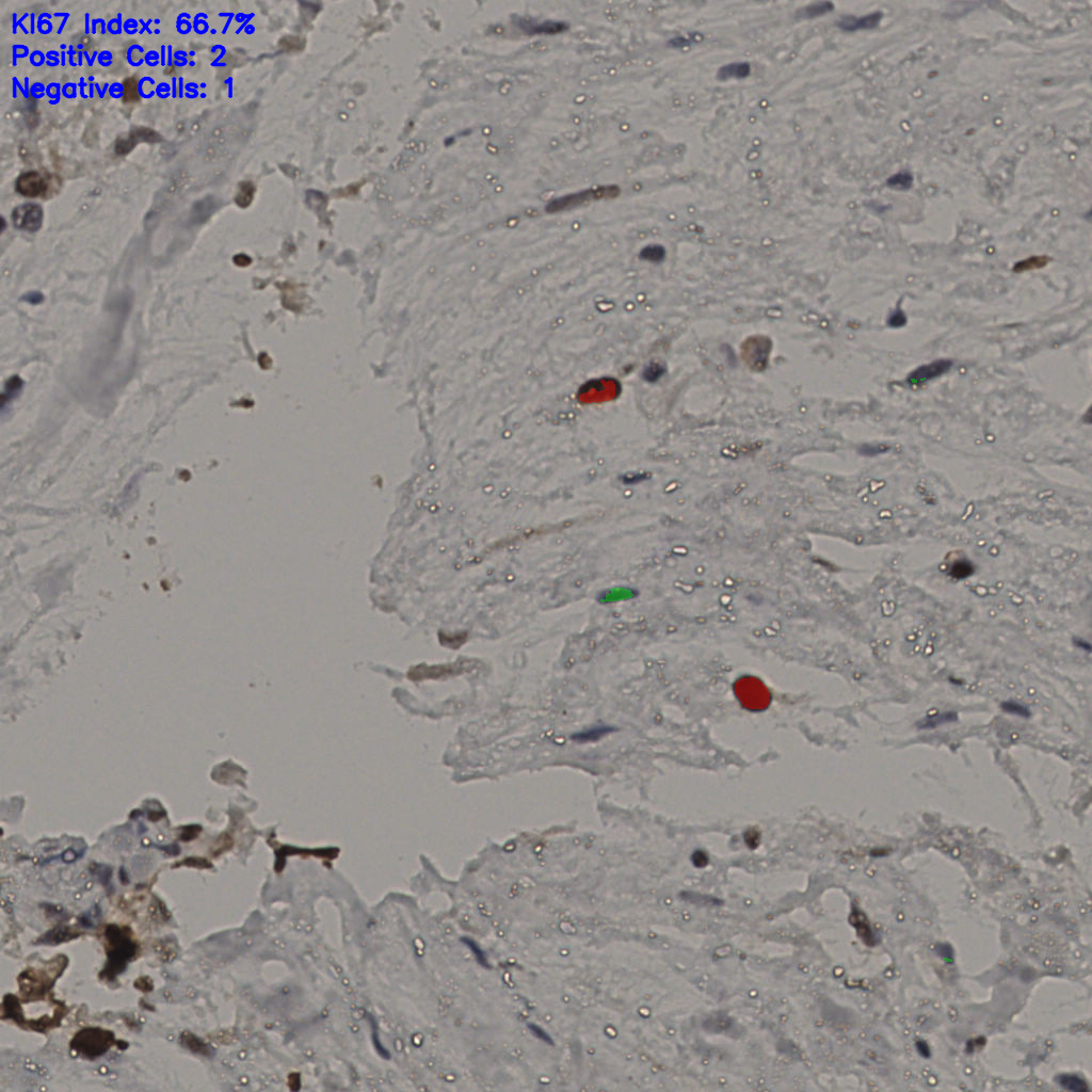 slice_18_51_x16128_y45696.png