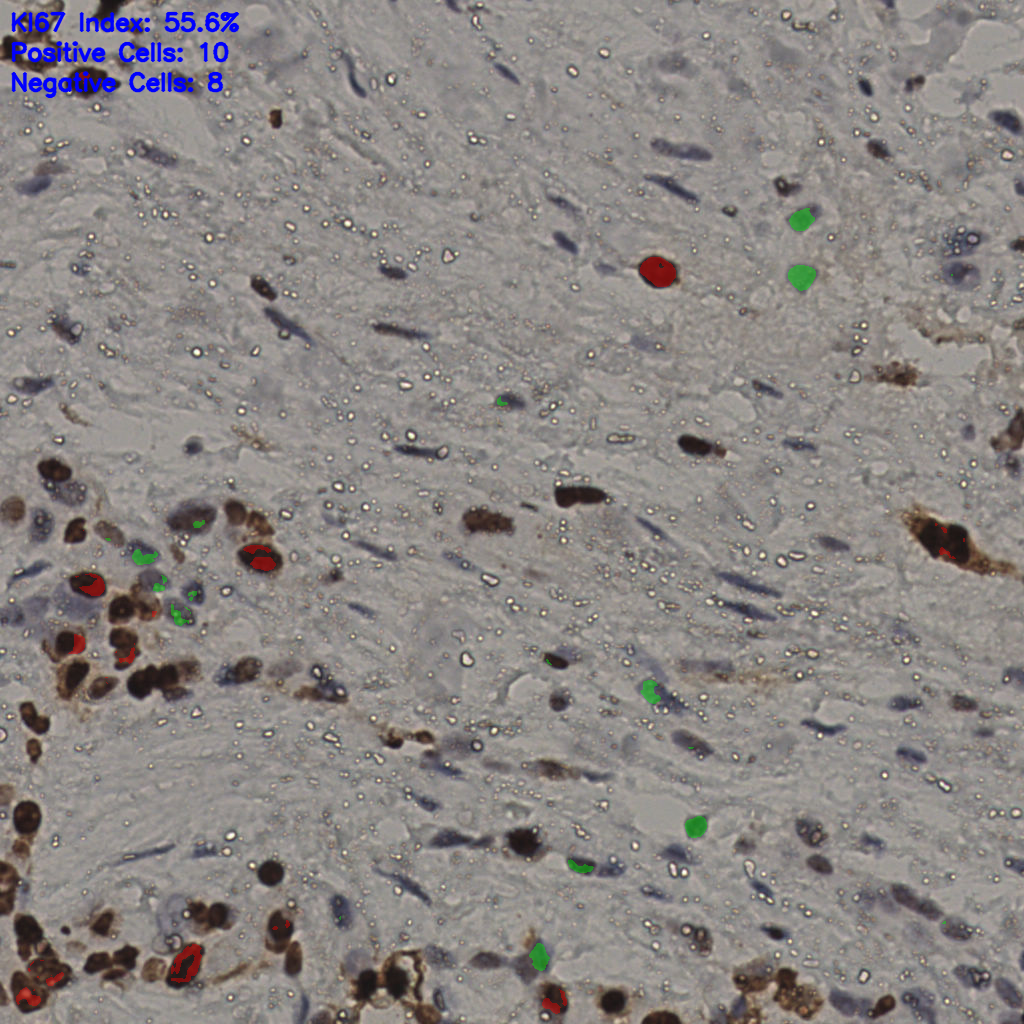 slice_18_52_x16128_y46592.png