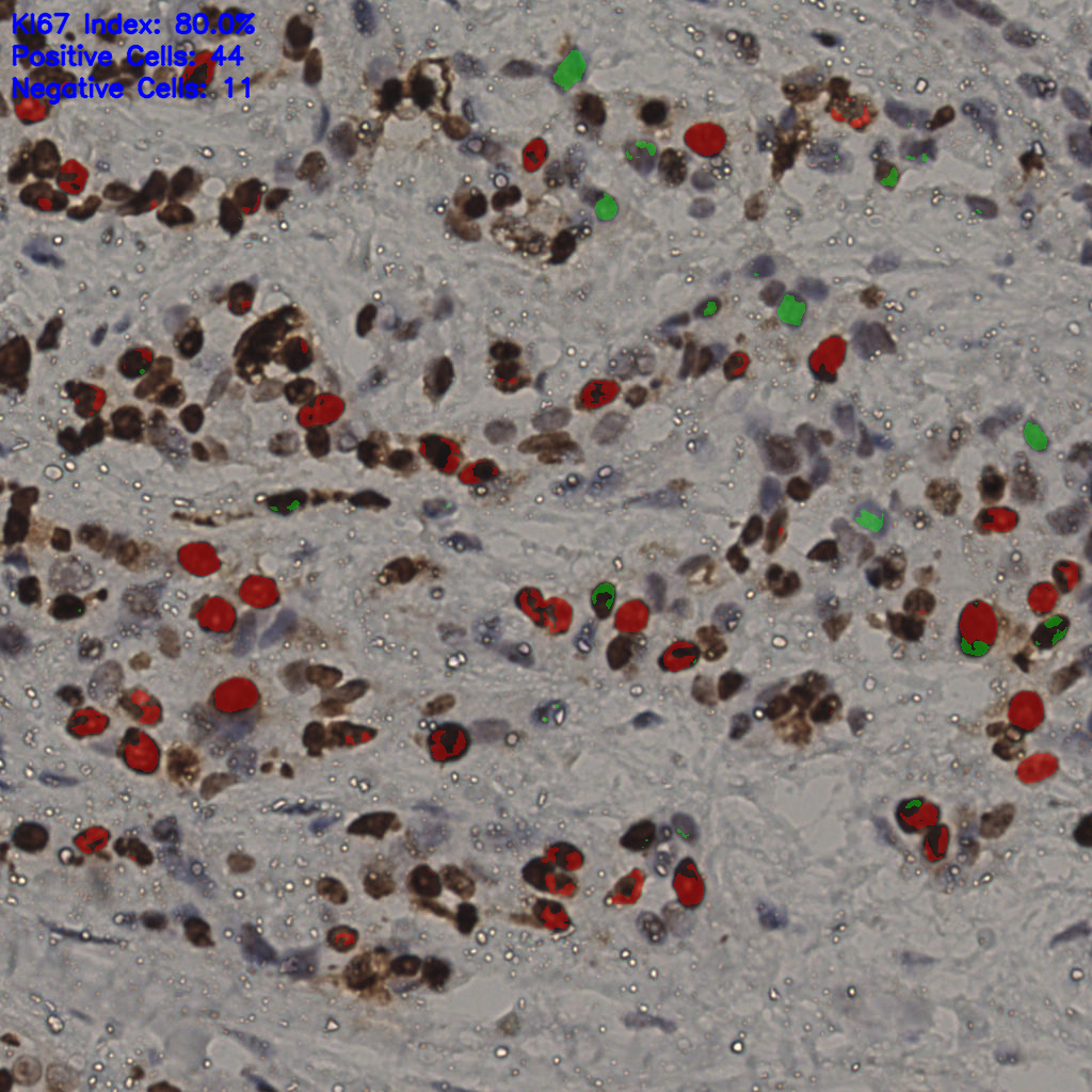 slice_18_53_x16128_y47488.png