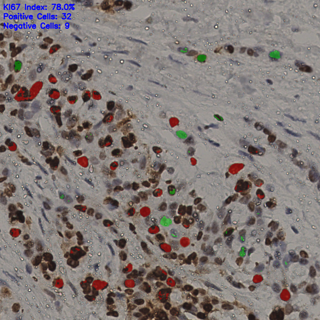 slice_18_54_x16128_y48384.png