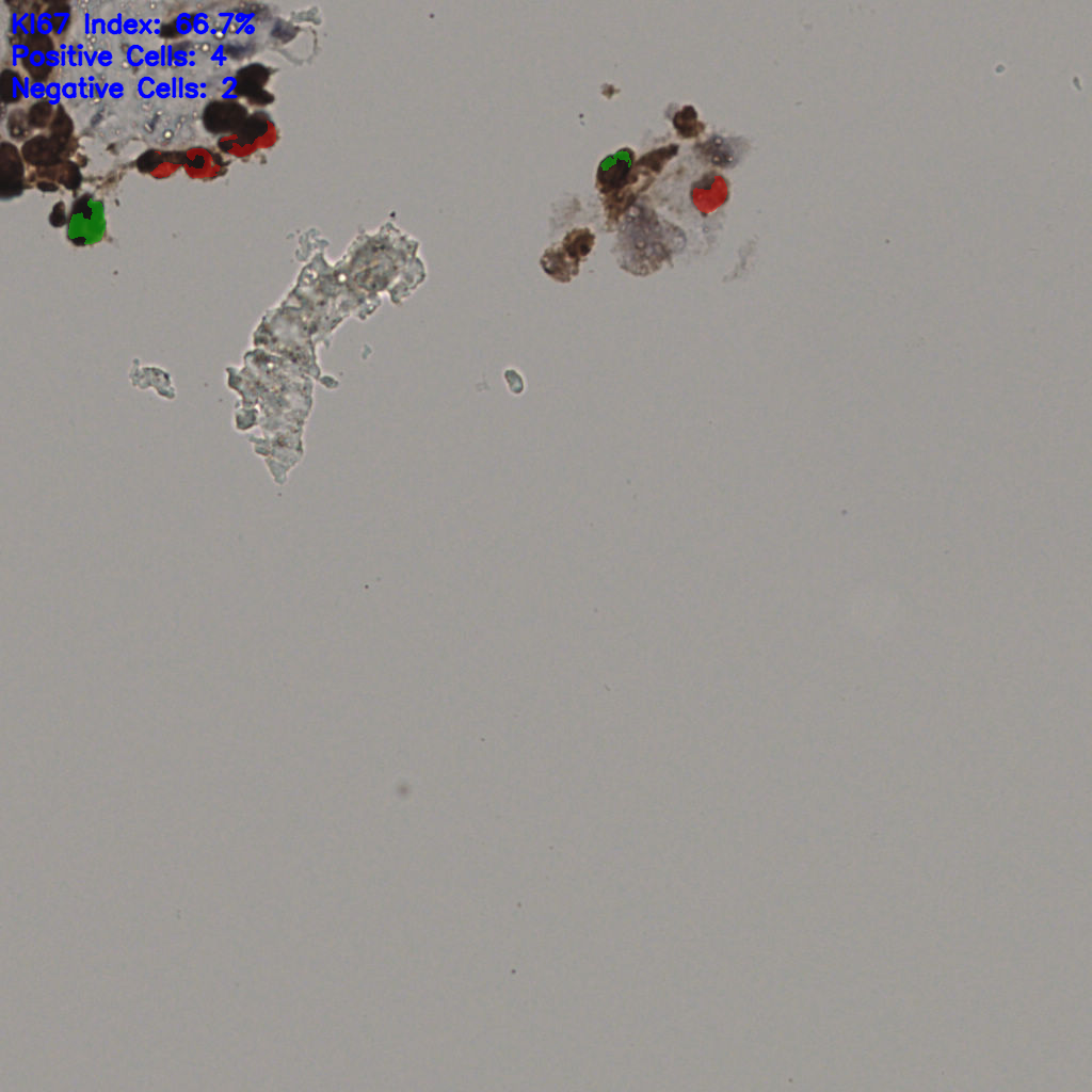 slice_18_57_x16128_y51072.png