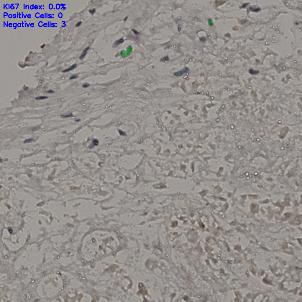 slice_19_36_x17024_y32256.png