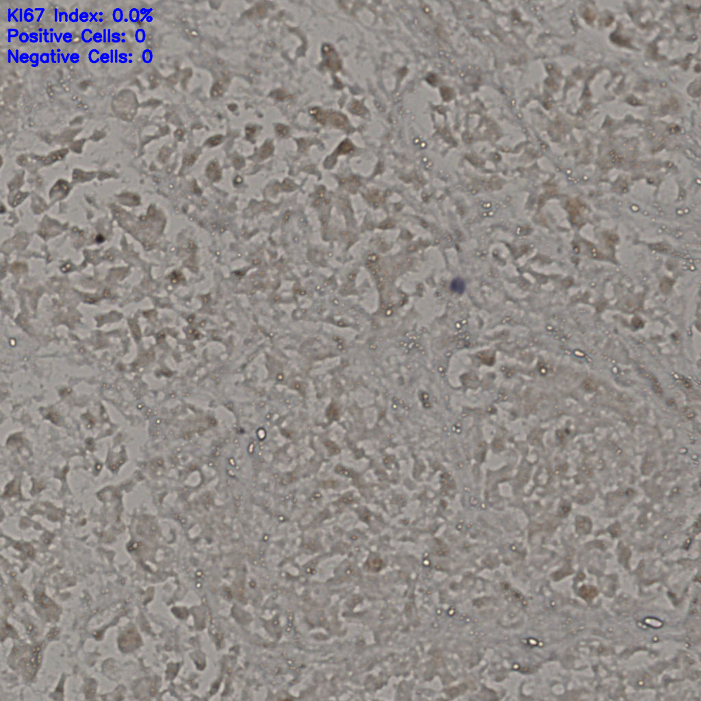 slice_19_37_x17024_y33152.png