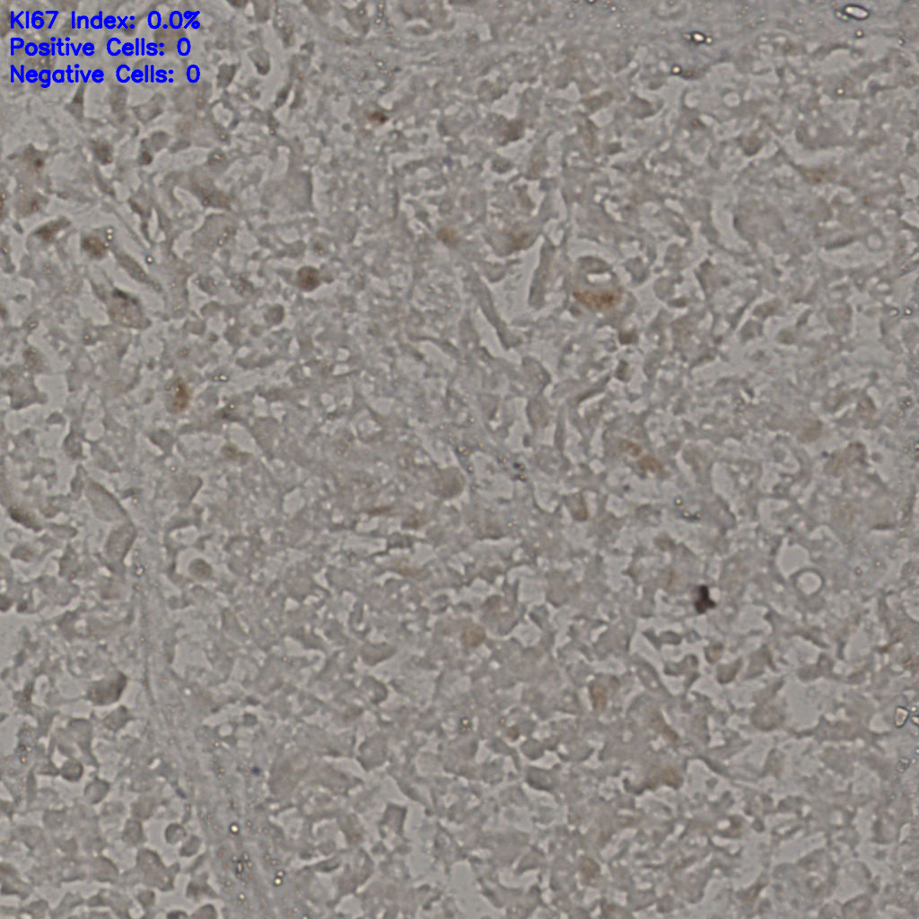 slice_19_38_x17024_y34048.png