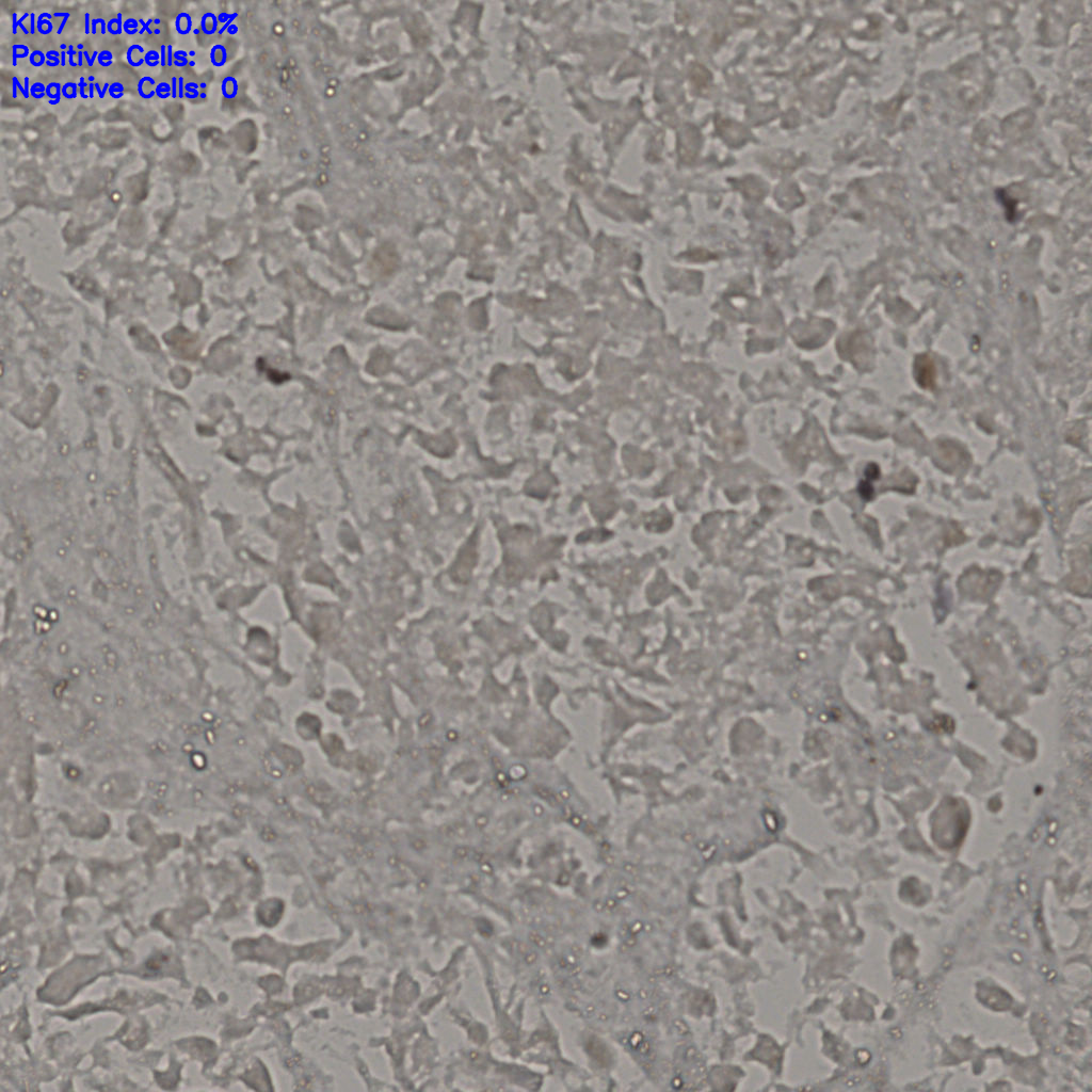 slice_19_39_x17024_y34944.png