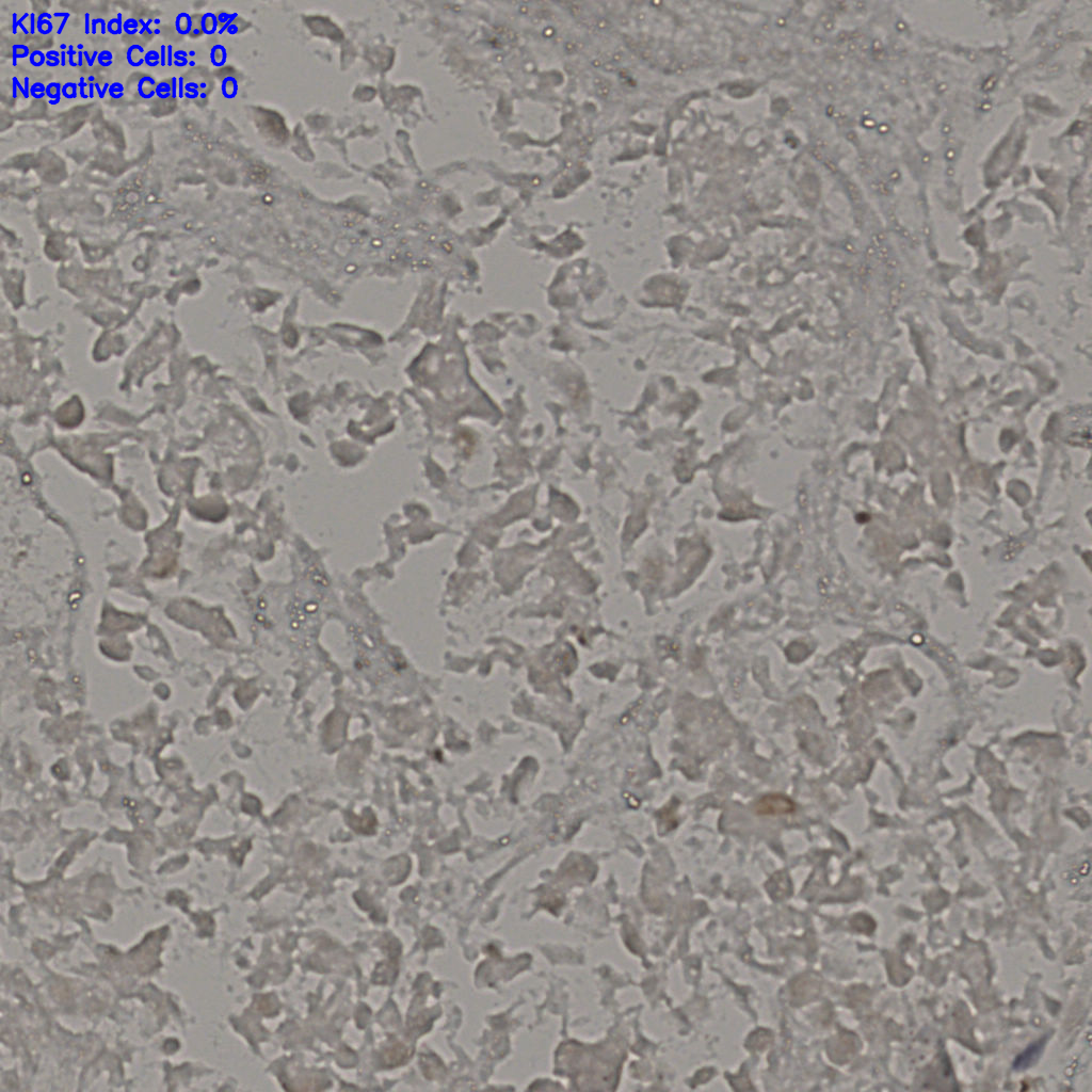 slice_19_41_x17024_y36736.png