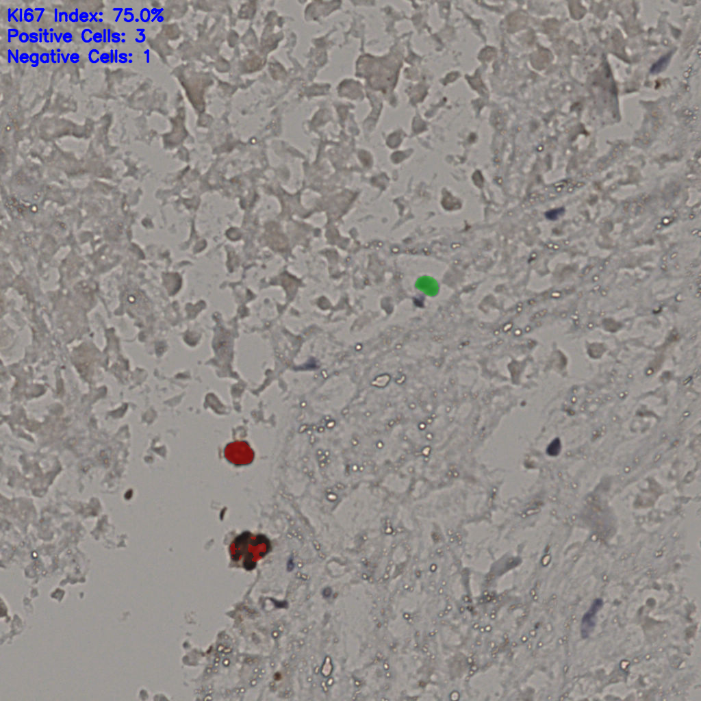 slice_19_42_x17024_y37632.png