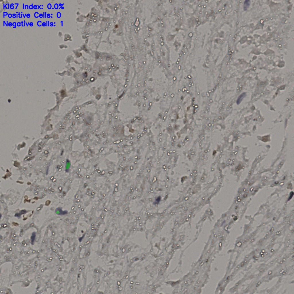 slice_19_43_x17024_y38528.png