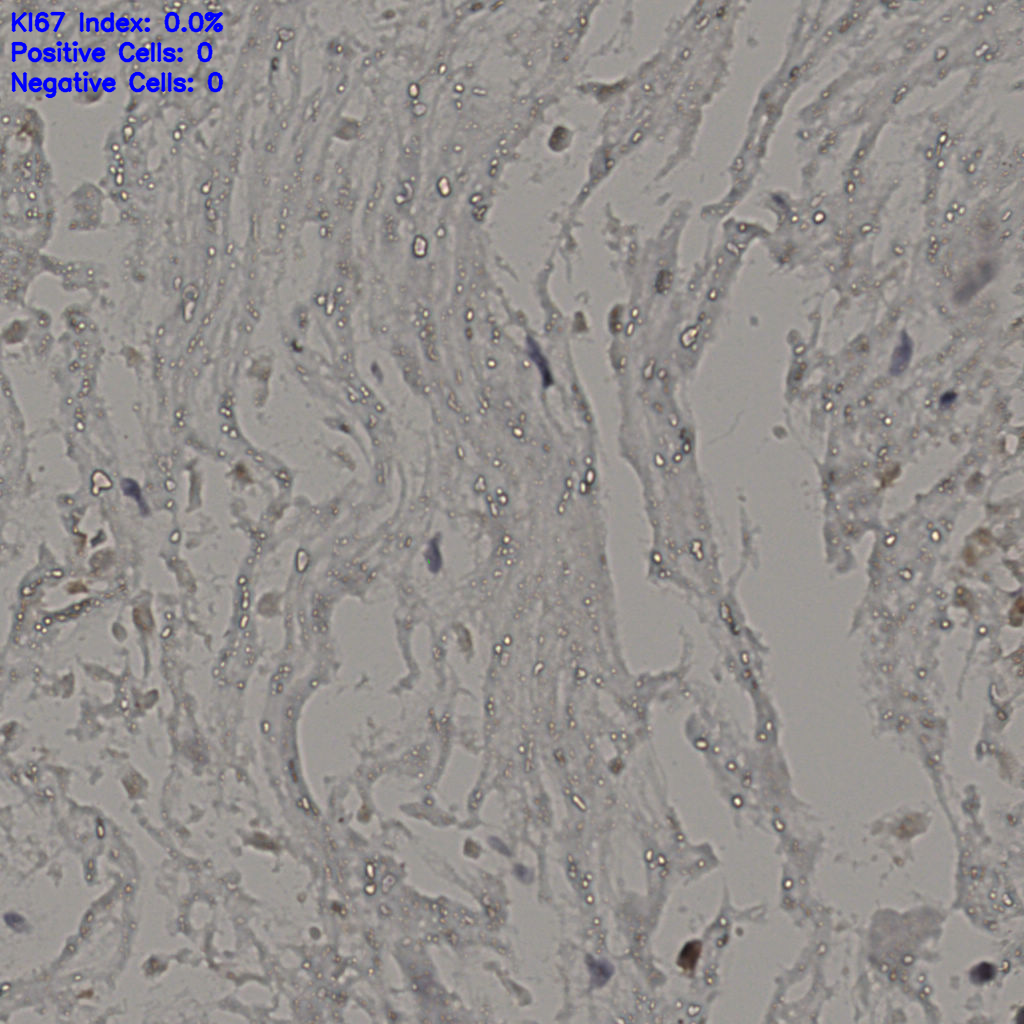 slice_19_44_x17024_y39424.png