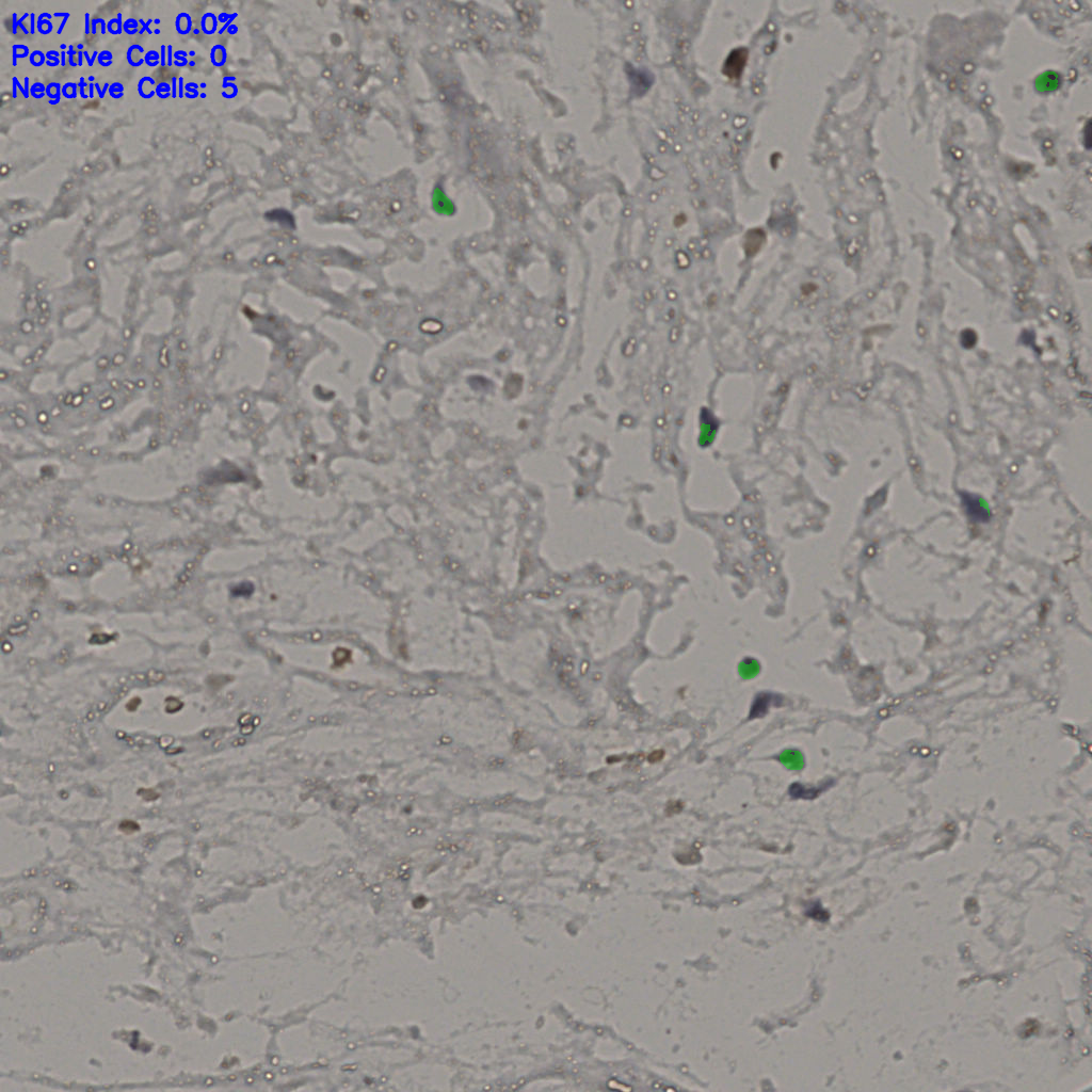 slice_19_45_x17024_y40320.png