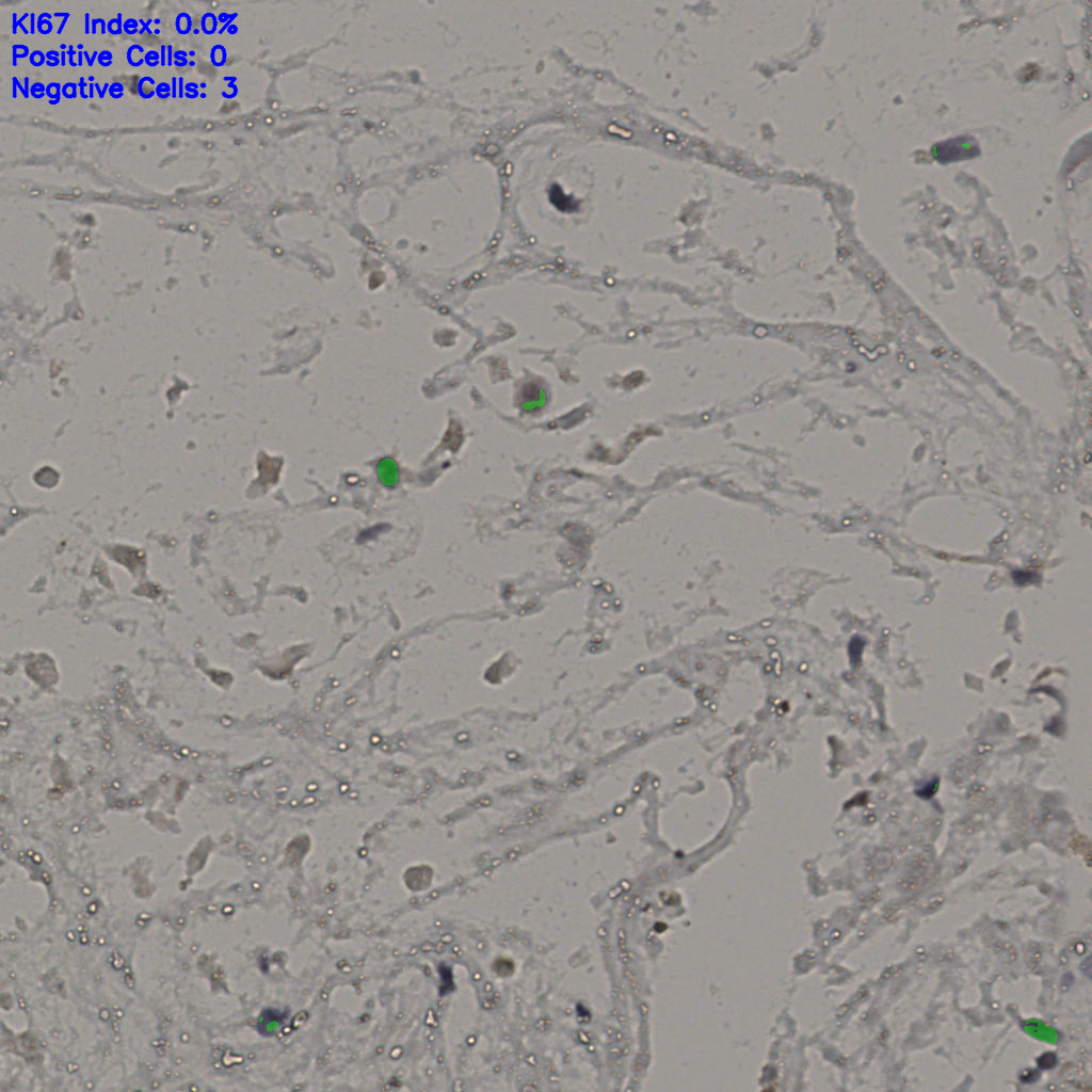 slice_19_46_x17024_y41216.png