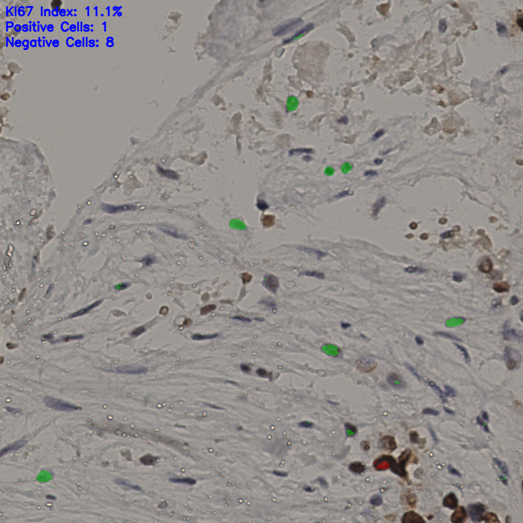 slice_19_49_x17024_y43904.png