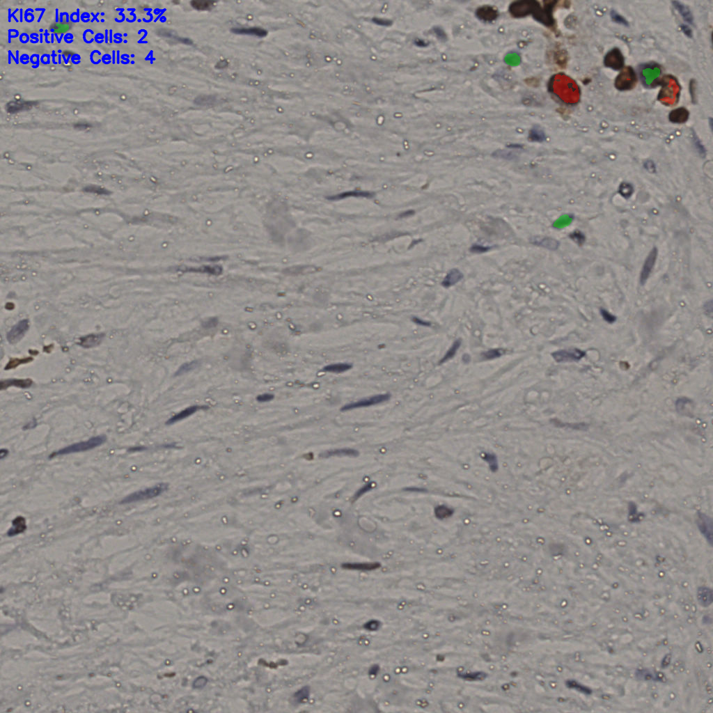slice_19_50_x17024_y44800.png
