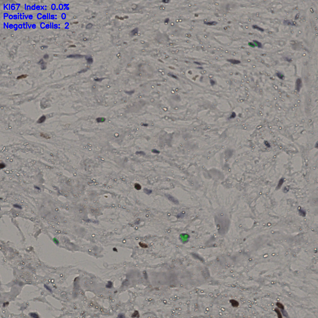 slice_19_51_x17024_y45696.png