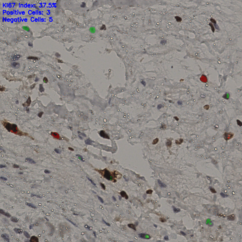 slice_19_52_x17024_y46592.png