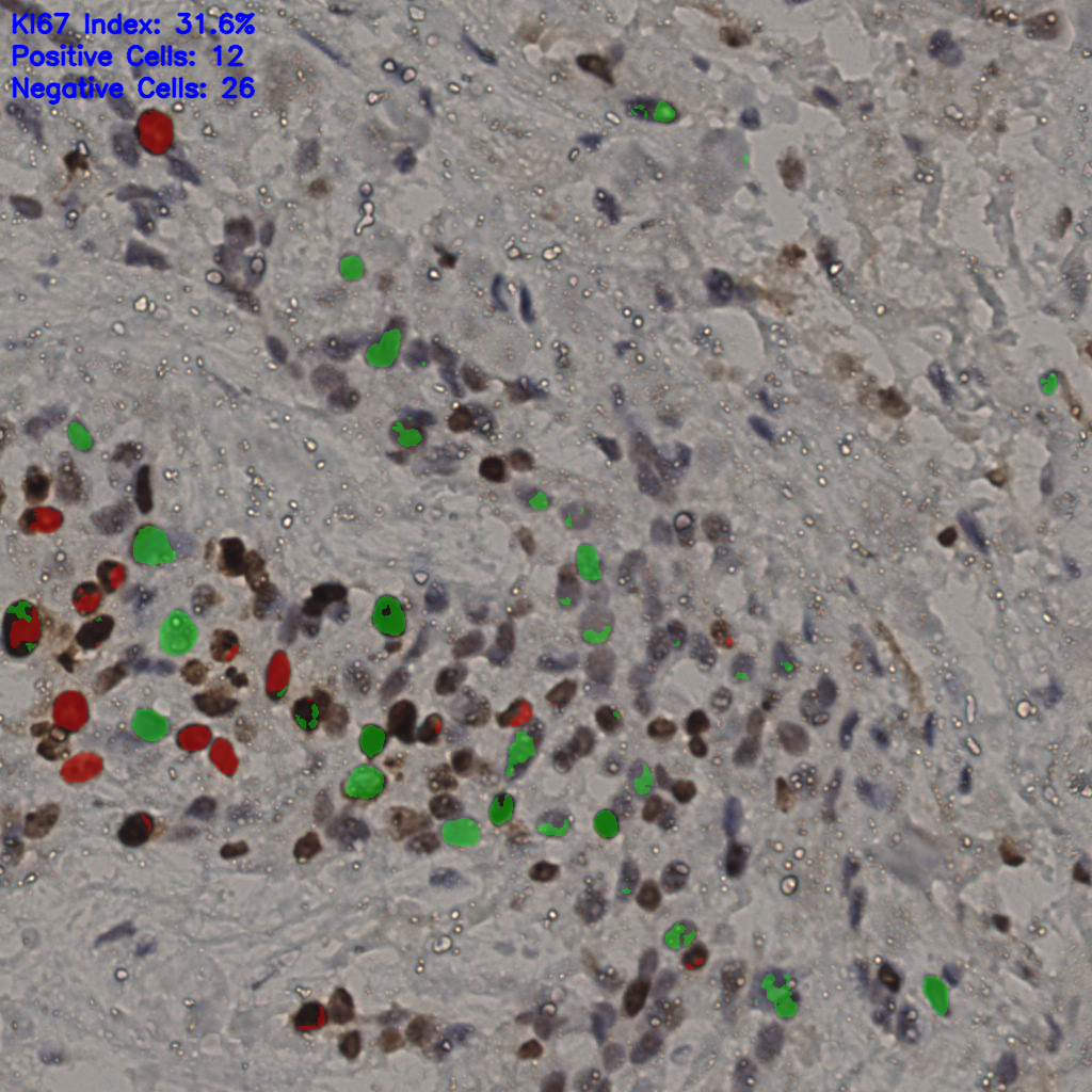 slice_19_53_x17024_y47488.png