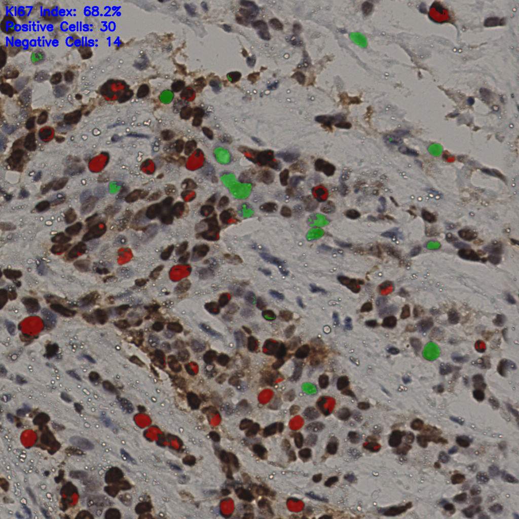 slice_19_55_x17024_y49280.png