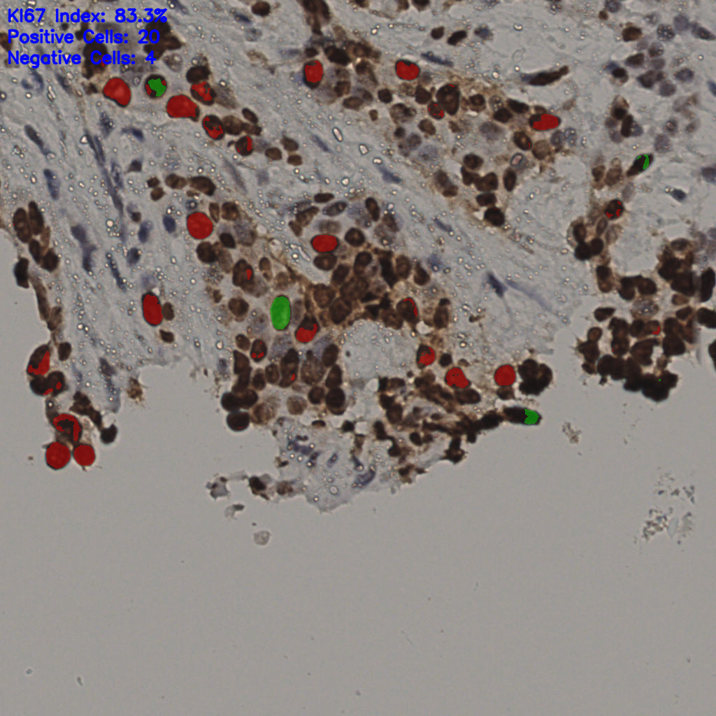 slice_19_56_x17024_y50176.png