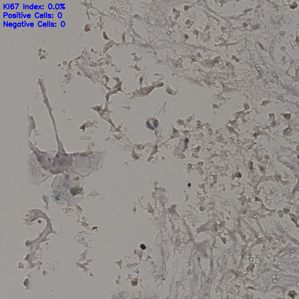 slice_20_32_x17920_y28672.png