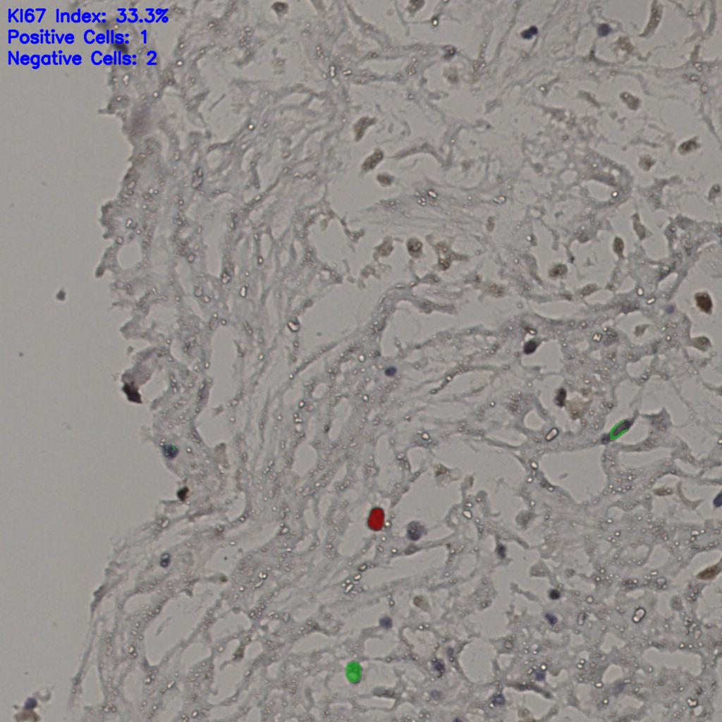 slice_20_34_x17920_y30464.png