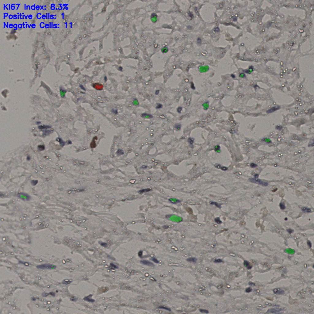 slice_20_35_x17920_y31360.png