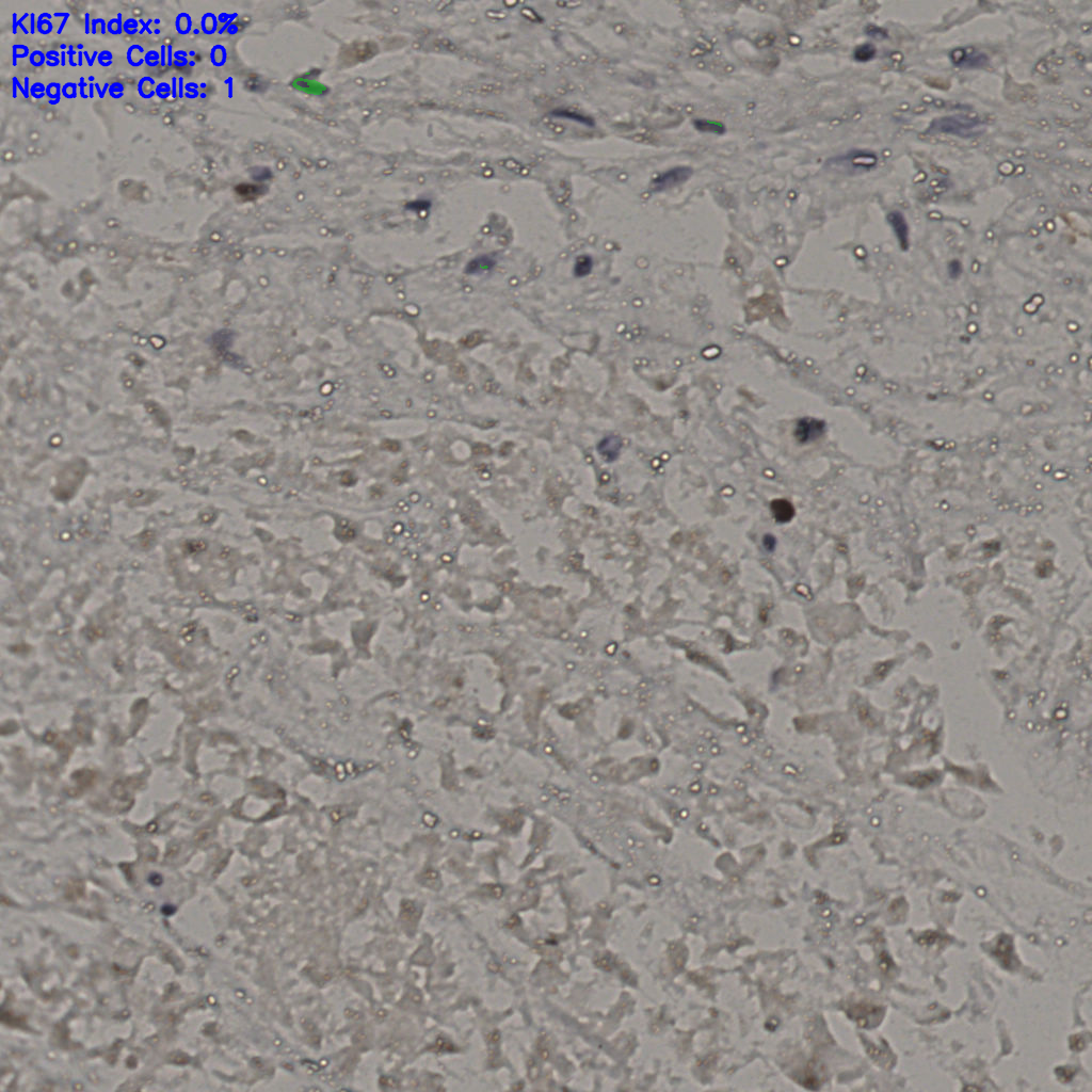 slice_20_36_x17920_y32256.png