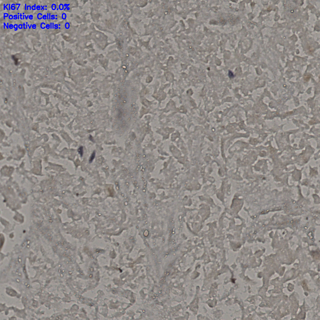 slice_20_39_x17920_y34944.png