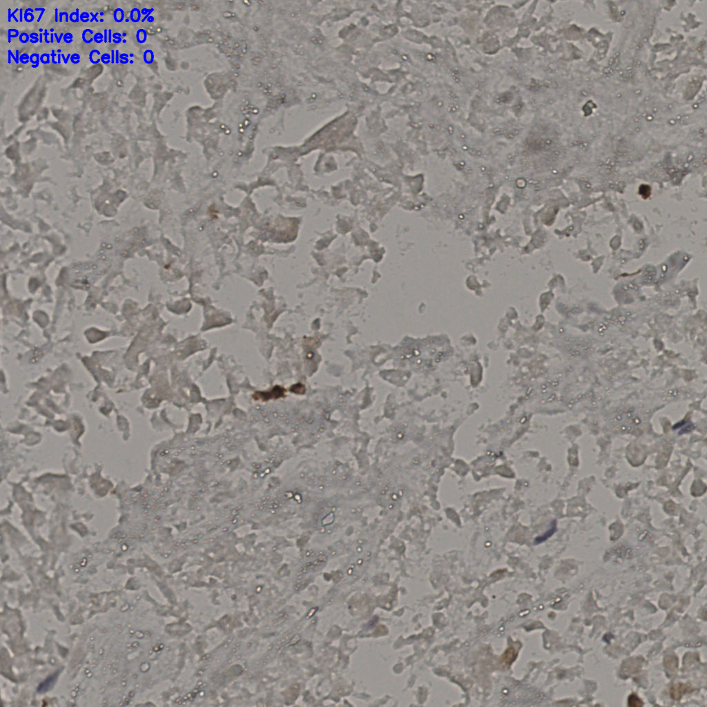 slice_20_41_x17920_y36736.png