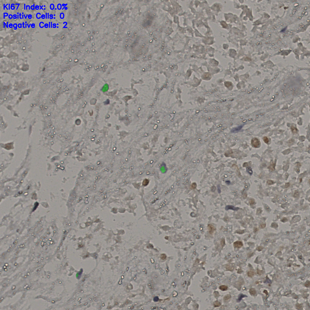slice_20_43_x17920_y38528.png
