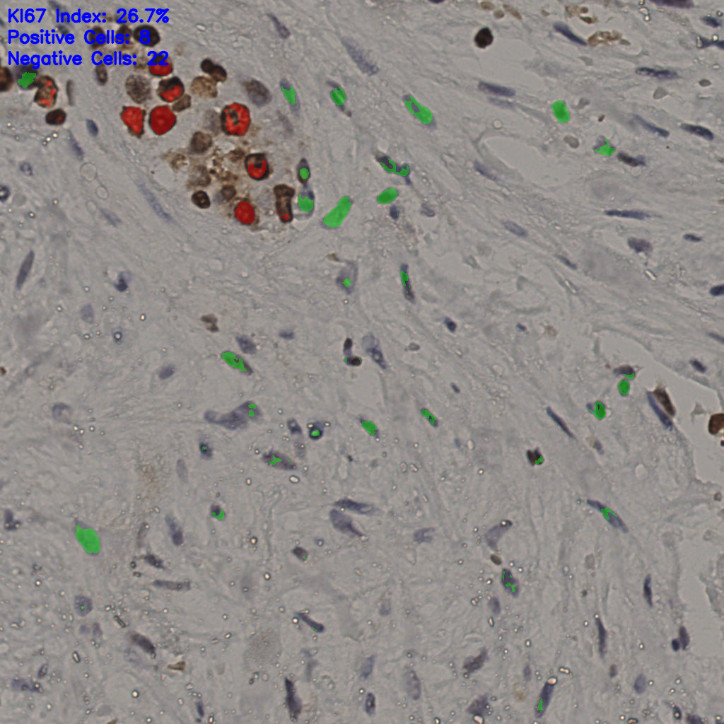 slice_20_50_x17920_y44800.png