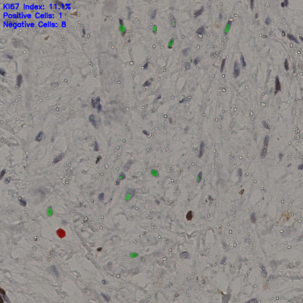 slice_20_51_x17920_y45696.png