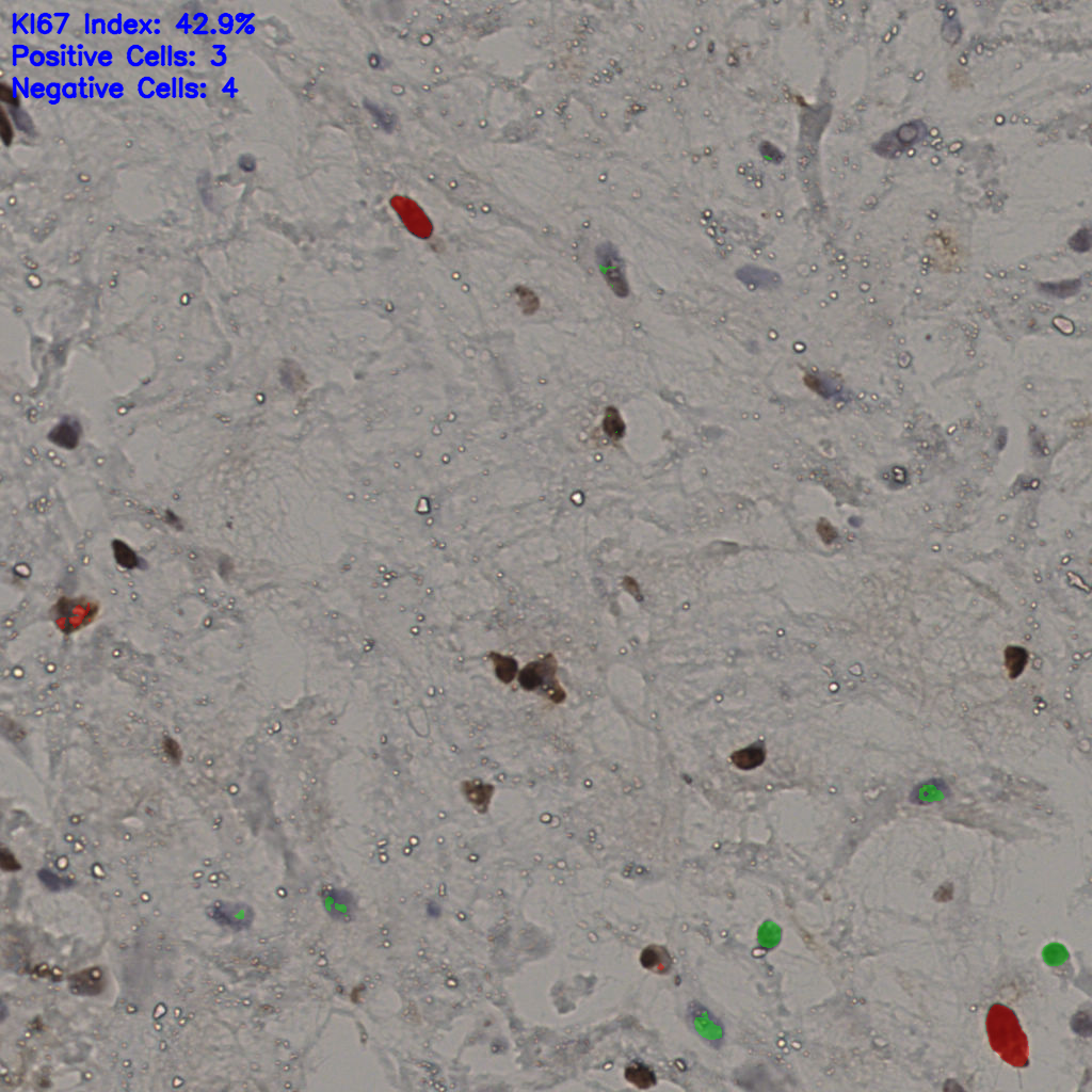 slice_20_52_x17920_y46592.png