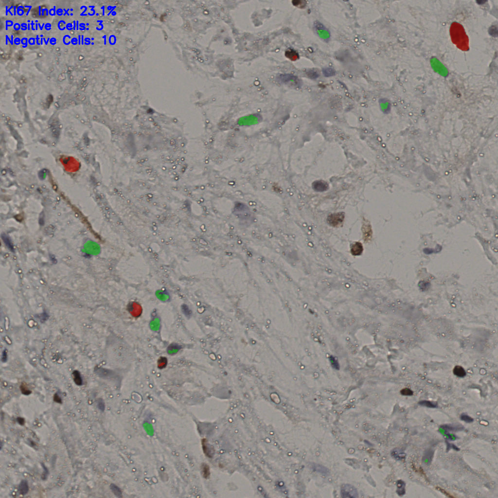 slice_20_53_x17920_y47488.png