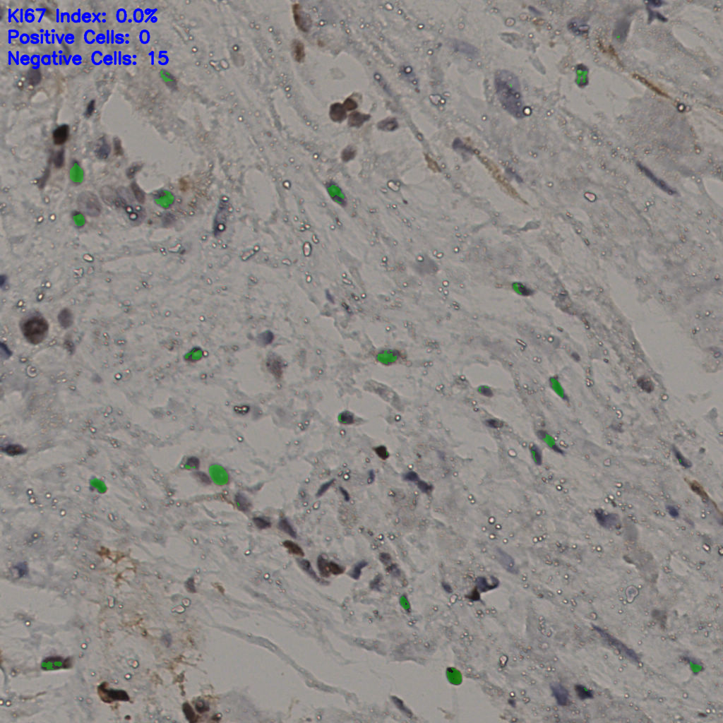slice_20_54_x17920_y48384.png