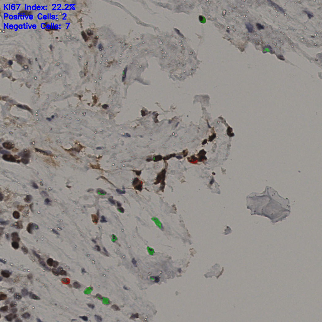 slice_20_55_x17920_y49280.png