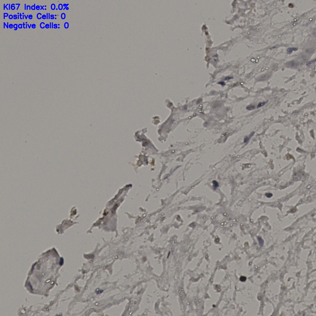 slice_21_29_x18816_y25984.png