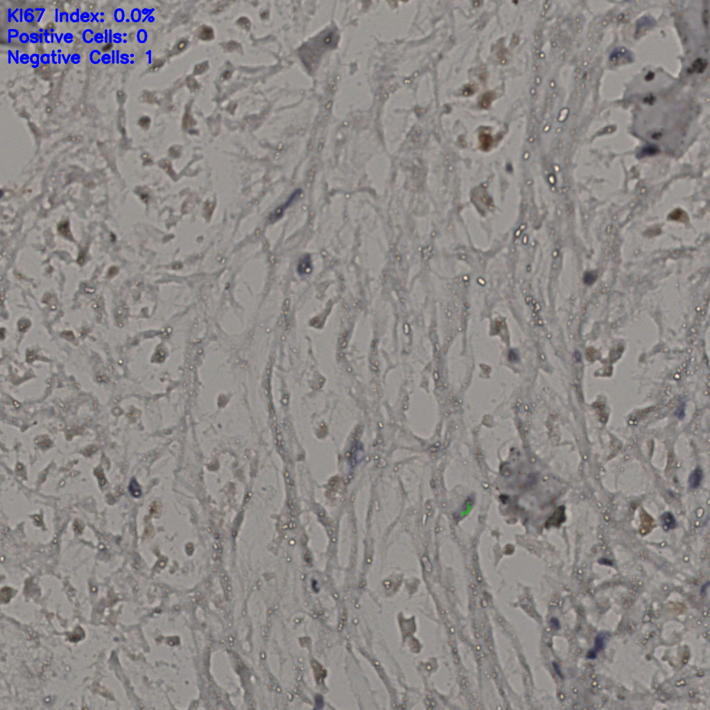slice_21_31_x18816_y27776.png