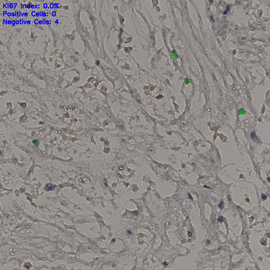 slice_21_32_x18816_y28672.png